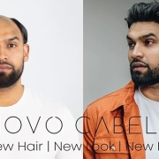 KIKU Salon’s non-surgical hair system transformations for Men from the leader Novo Cabelo, not only provide aesthetic improvements but also have a profound impact on our clients’ self-esteem and overall well-being.