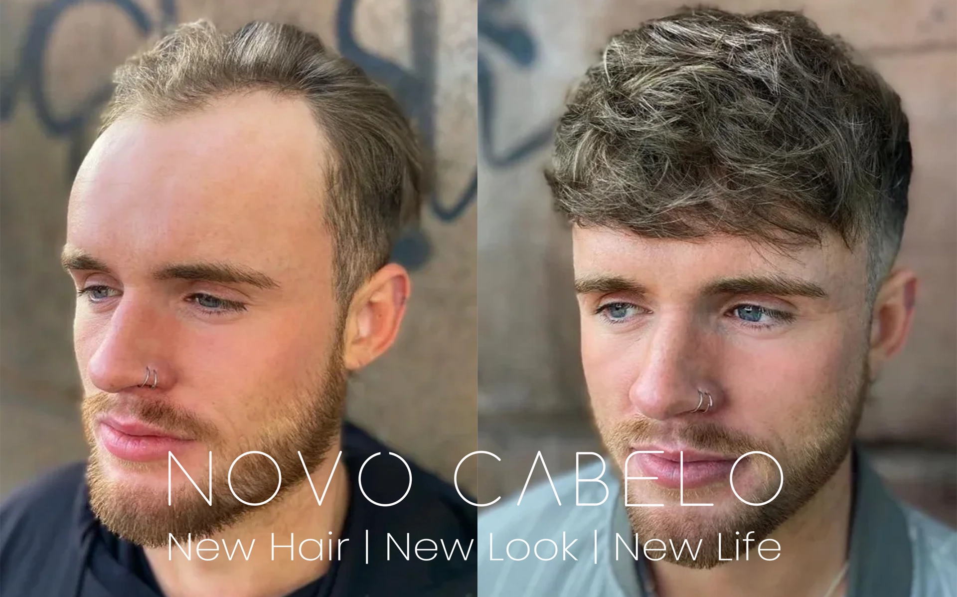 KIKU Salon’s non-surgical hair system transformations from the leader Novo Cabelo, not only provide aesthetic improvements but also have a profound impact on our clients’ self-esteem and overall well-being. KIKU Salon’s non-surgical hair system transformations from the leader Novo Cabelo, not only provide aesthetic improvements but also have a profound impact on our clients’ self-esteem and overall well-being.